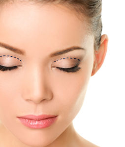 Eyelid correction